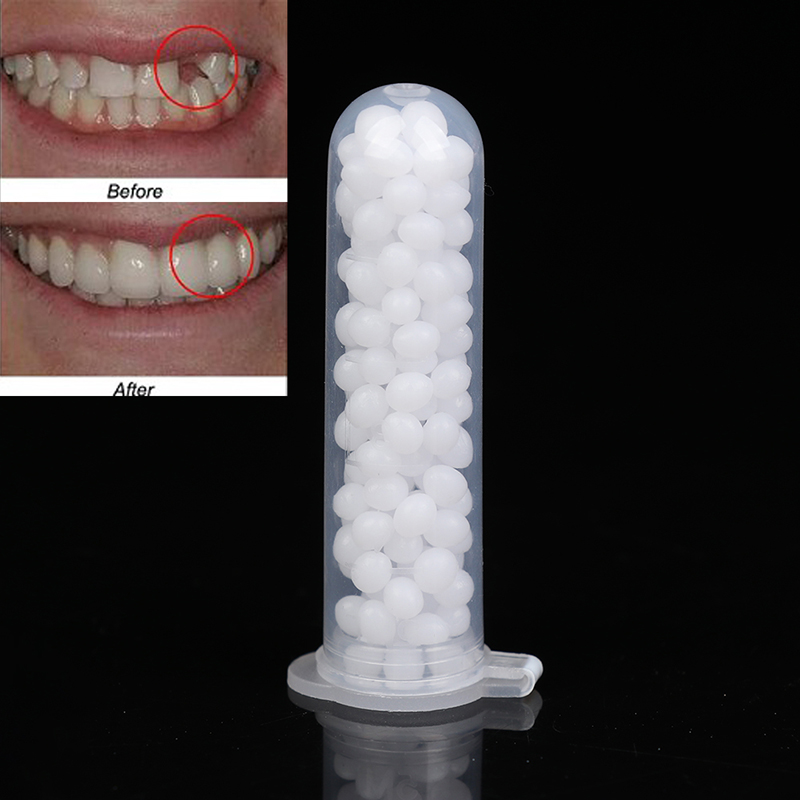 【K】1 กล่อง ชุดซ่อมฟันชั่วคราว  - Teeth Whitening Kit บทวิจารณ์และราคา