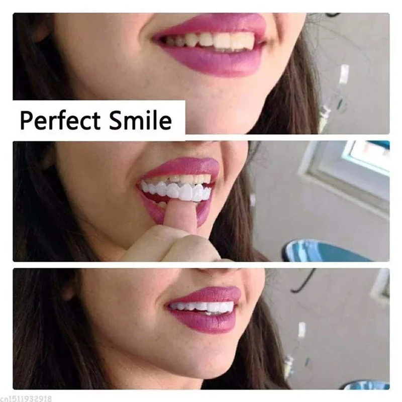 ชุดฟันปลอมแบบสวม ปรับได้ ฟันปล - Teeth Whitening Kit บทวิจารณ์และราคา